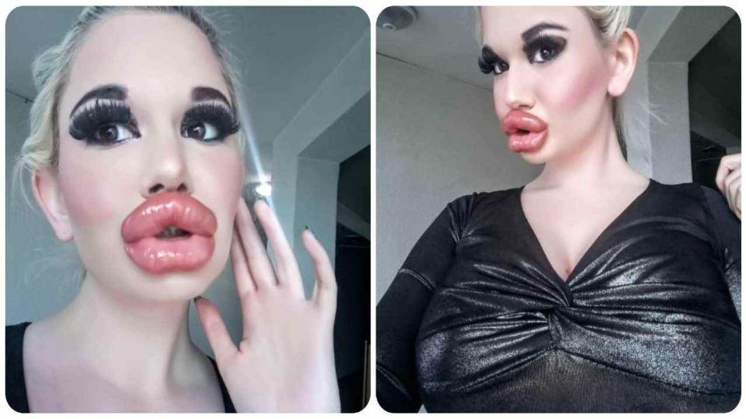 Lei è la donna con le labbra più grandi del mondo ma avete visto come era prima? Bellissima Lei è la donna con le labbra più grandi del mondo ma avete visto come era prima? Bellissima